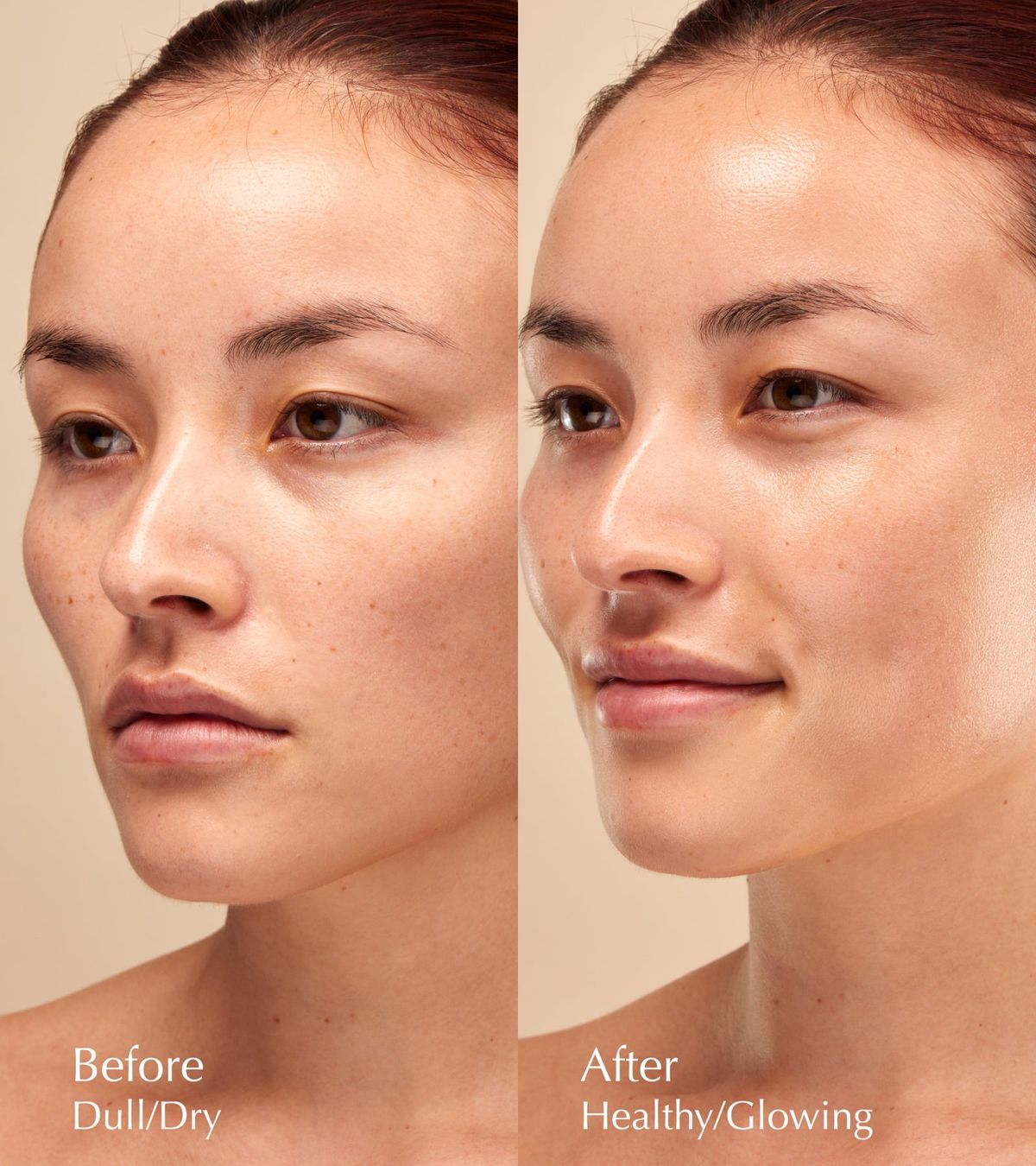 before and after image 3