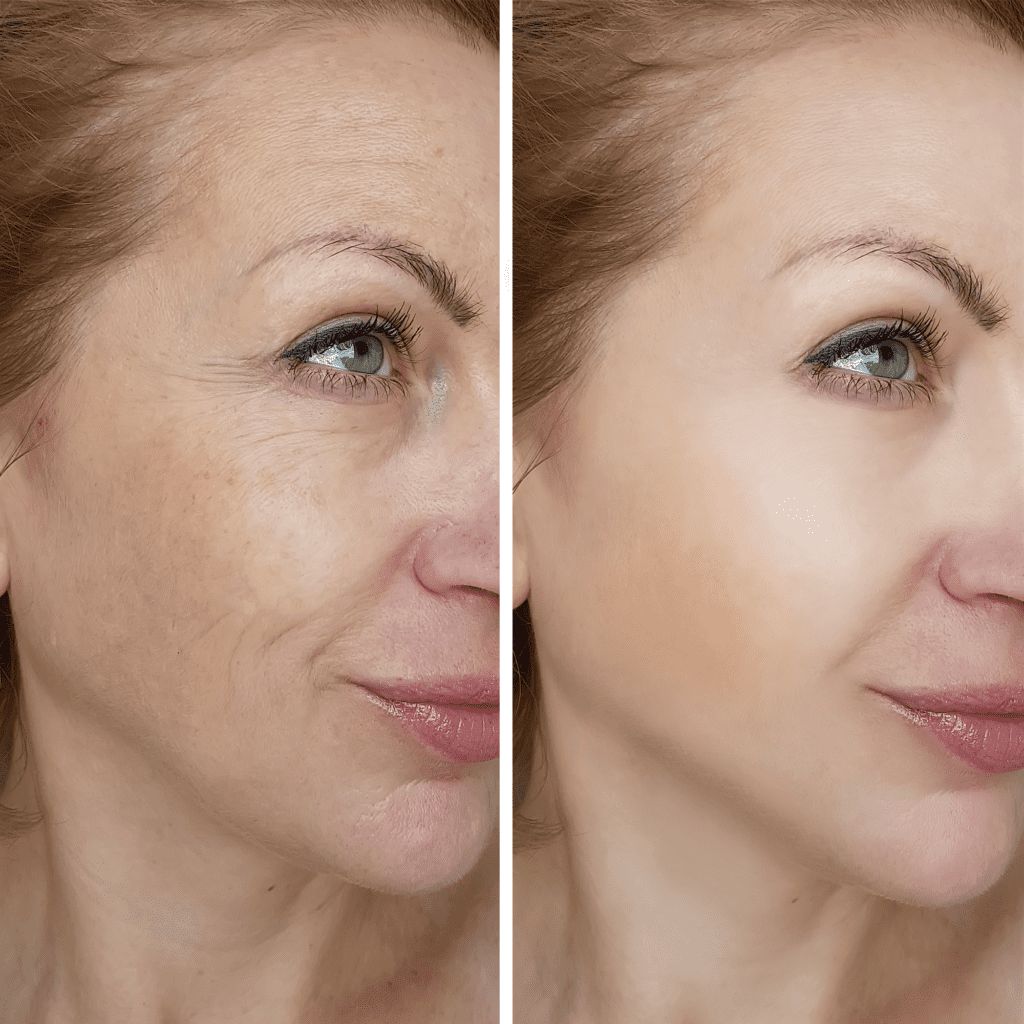 before and after image 4