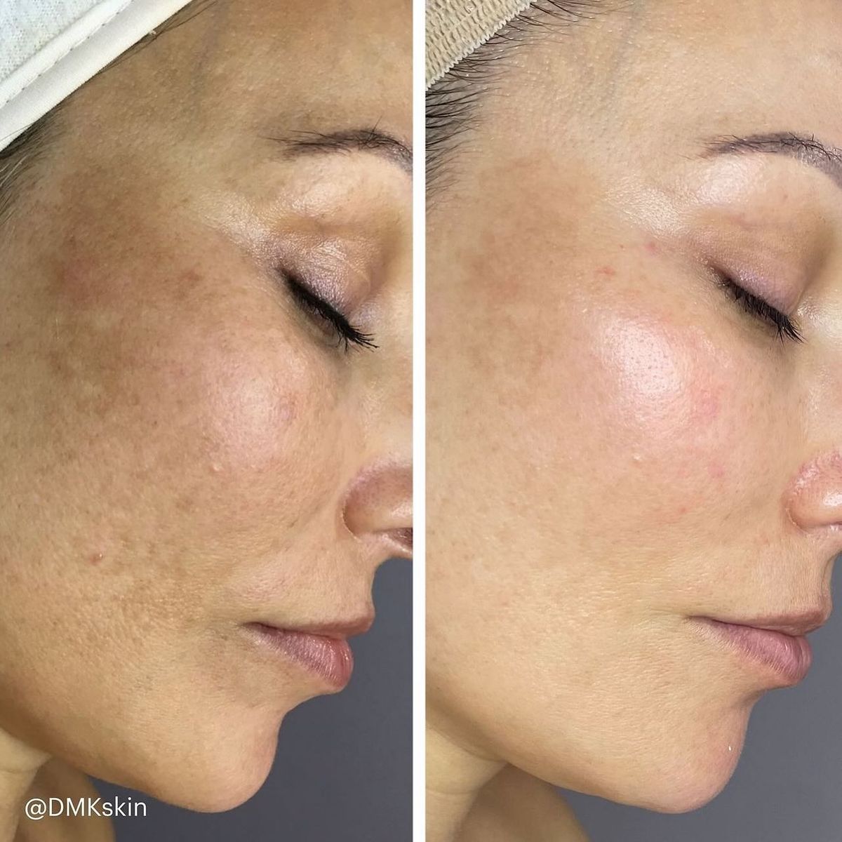 before and after image 5